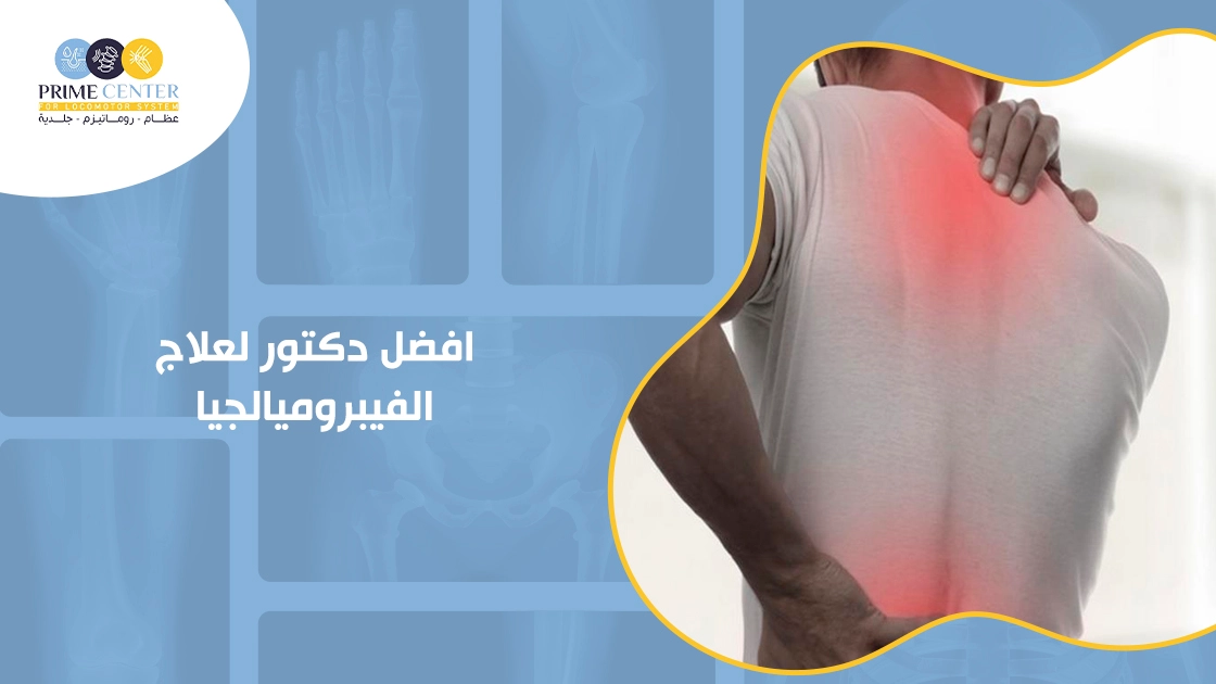 افضل دكتور لعلاج الفيبروميالجيا