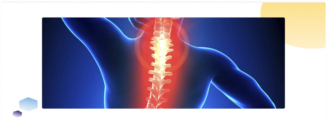علاج خشونة الفقرات