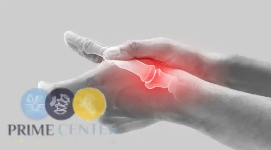 كيفية اكتشاف مرض الروماتويد