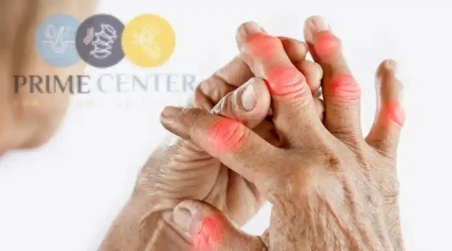 كيفية تخفيف أعراض الفيبروميالجيا