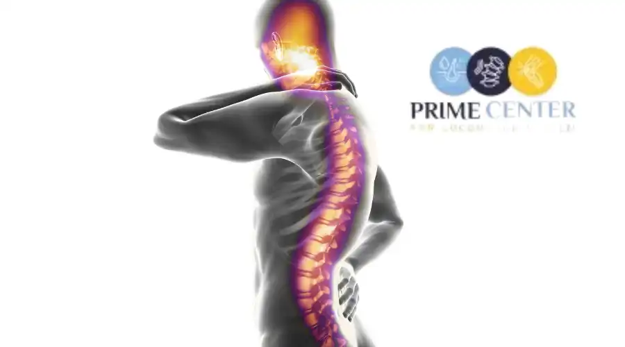 اعراض التهاب الفقرات العنقية