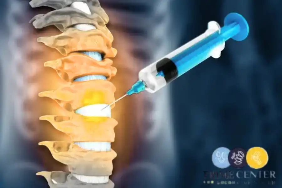 عملية حقن جذور الاعصاب مؤلمة