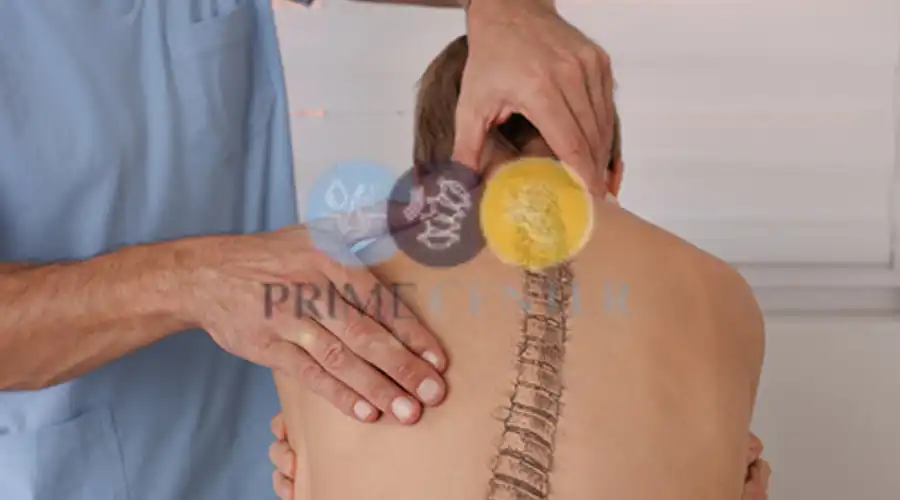 اسباب خشونة العمود الفقري