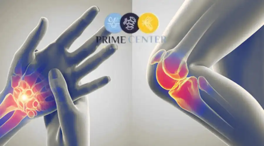 أسباب التهاب المفاصل