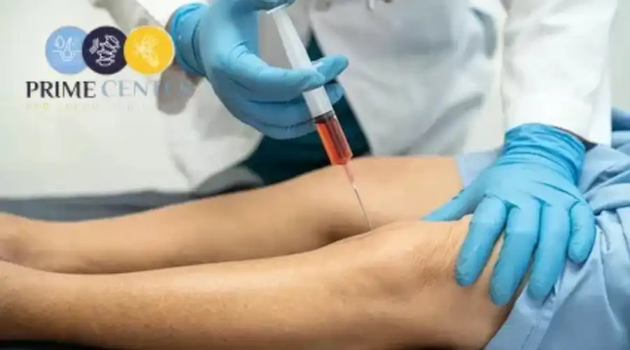 أنواع وأسعار حقن الركبة بالبلازما في مصر