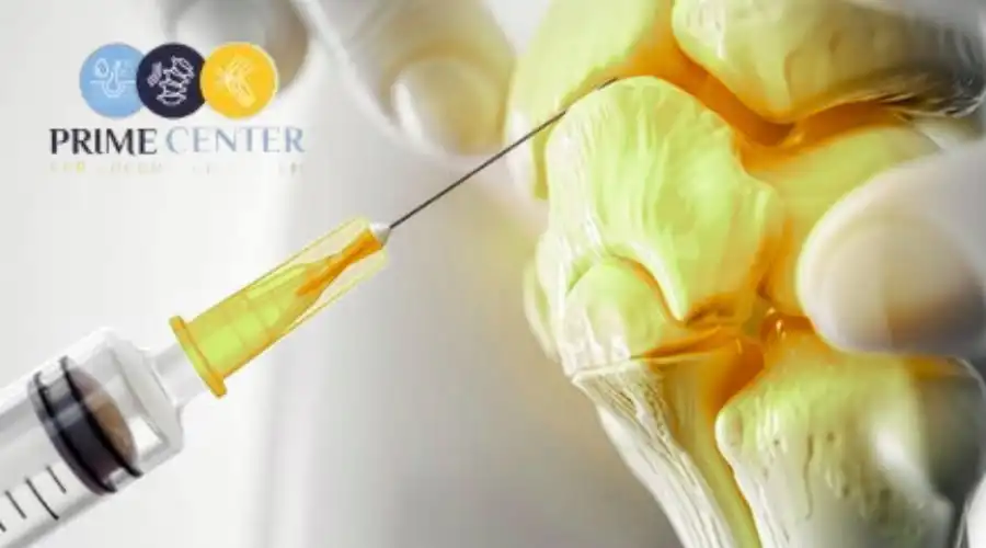 تكلفة حقن التهاب المفاصل فى مصر