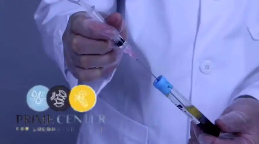 مراكز حقن البلازما للعظام