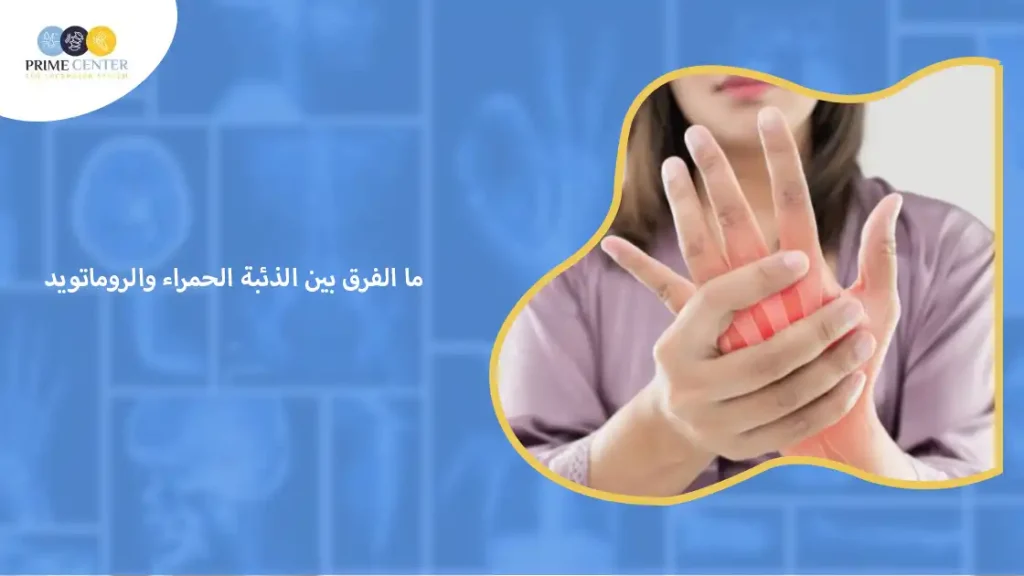 ما الفرق بين الذئبة الحمراء والروماتويد؟