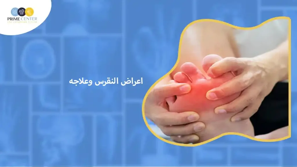 اعراض النقرس وعلاجه