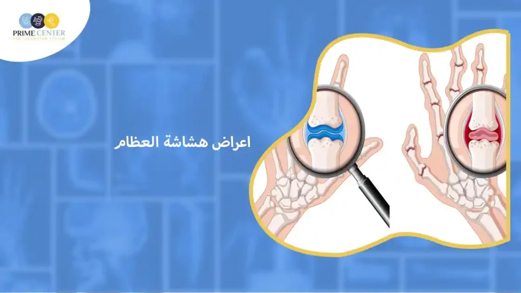 اعراض هشاشة العظام