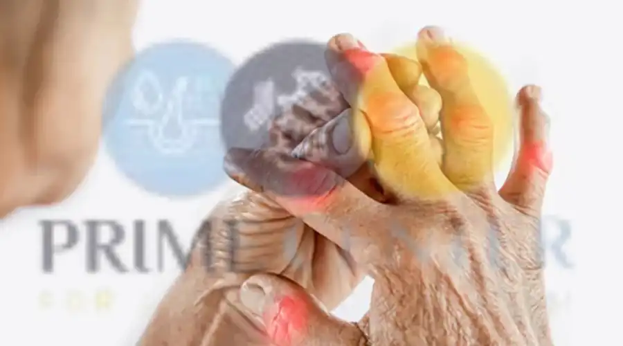 عوامل الخطورة مرض الروماتويد