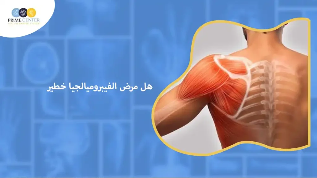 هل مرض الفيبروميالجيا خطير؟