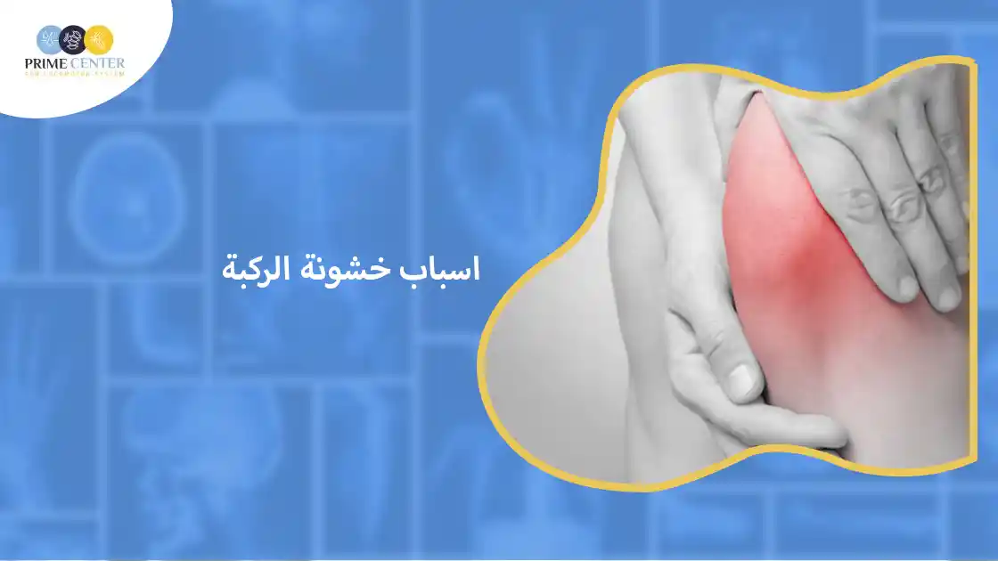 اسباب خشونة الركبة