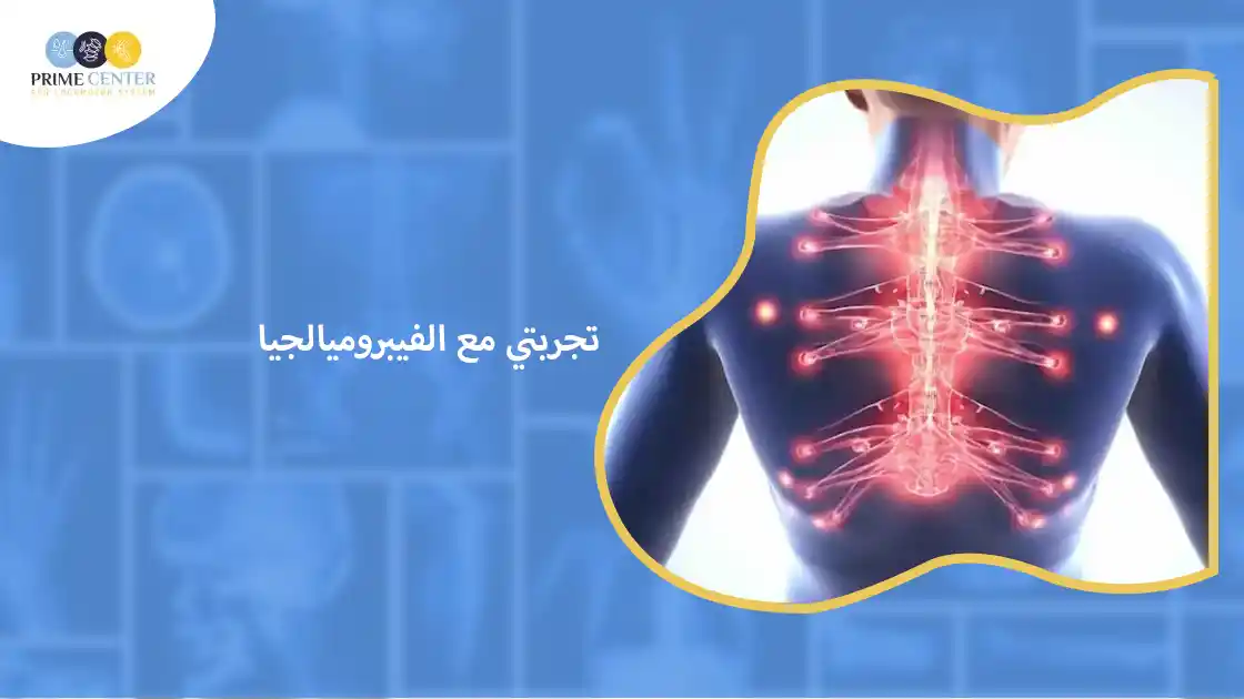 تجربتي مع الفيبروميالجيا