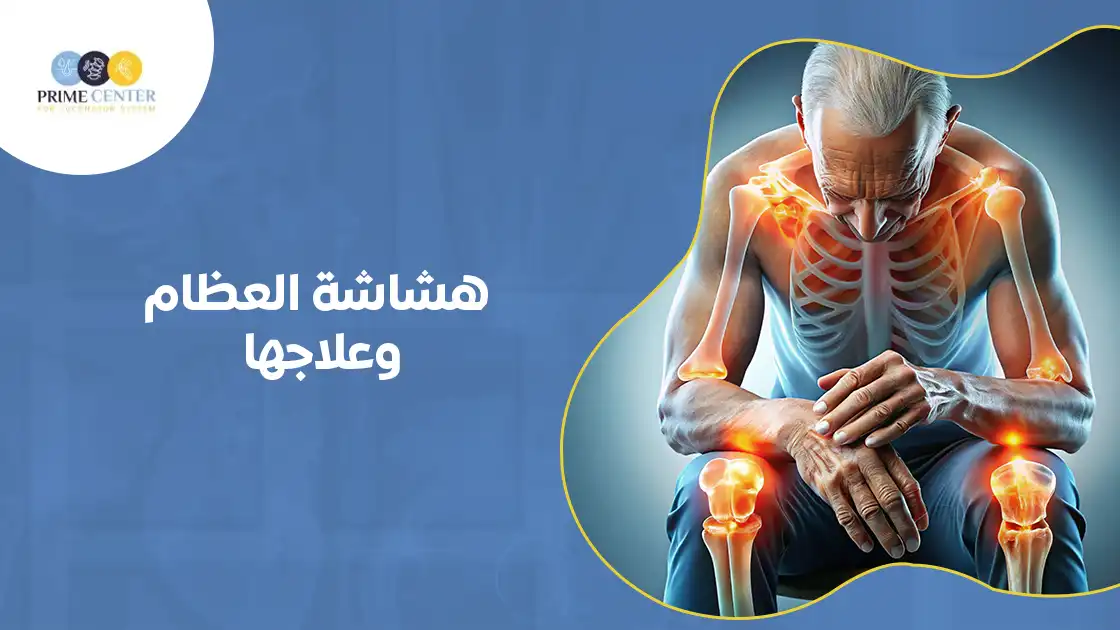 هشاشة العظام وعلاجها